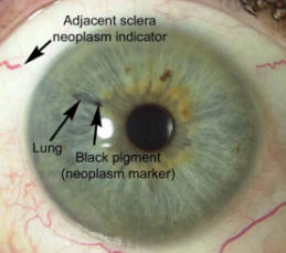 How do you read an iridology eye chart?