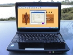 Meridian Diagnostic Instrument with Laptop 13.3 inch screen