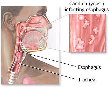 Signs of steroid use in men