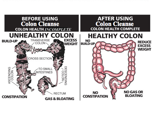 Colon Cleansing Doctors Office