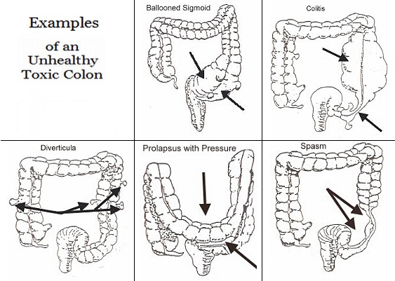 Bowel Movements Healthy Diet