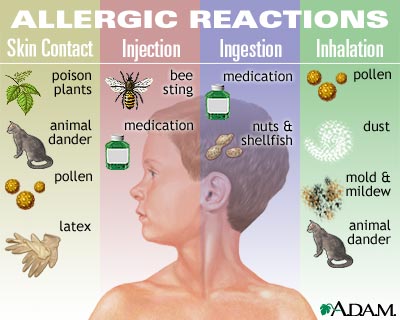 allergies allergic reaction when allergy happens reactions causes skin testing know why