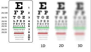 Natural Vision Improvement